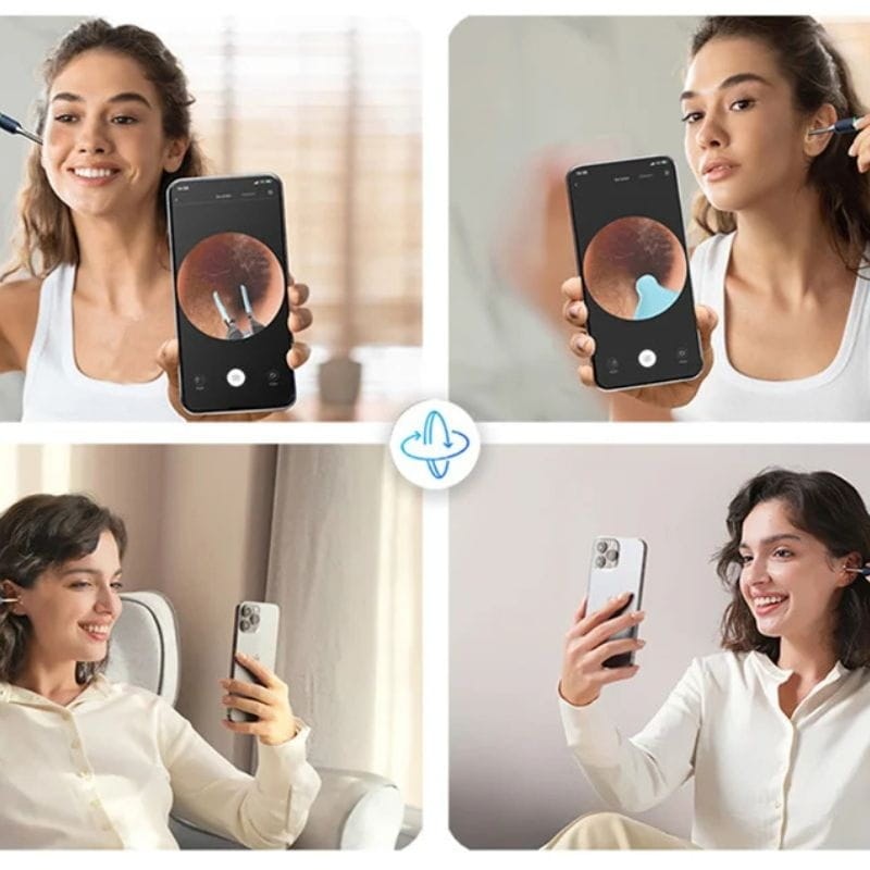 Rod Bebird Note 5 Pro Branco - Otoscópio Profissional para Limpeza dos Ouvidos